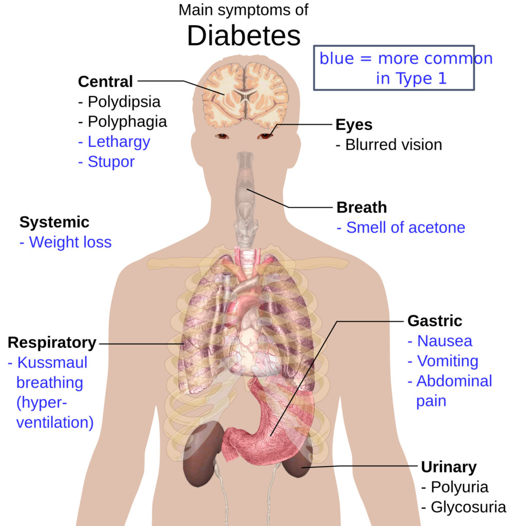 How To Control Diabetes Naturally