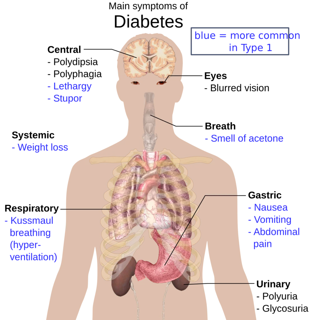 How To Control Diabetes Naturally